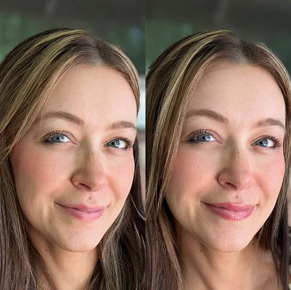 Lip-Boosting Serum™